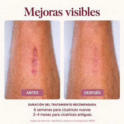 Lámina de Silicona para Cicatrices e Hidratación